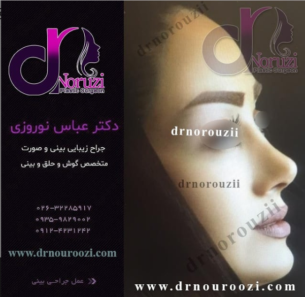 عوارض جراحی زیبایی بینی