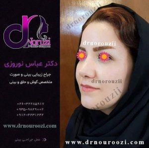 اصلاح مشکلات بینی