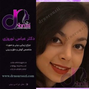 تصویر بینی جراحی شده