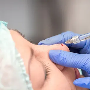 تزریق کورتون به بینی