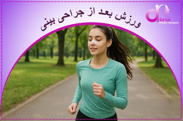 Exercise after nose surgery