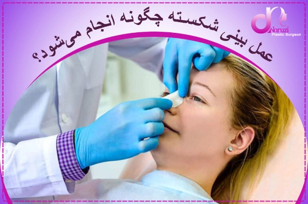 عمل بینی شکسته چگونه انجام میشود؟