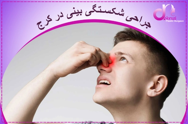 جراحی شکستگی بینی در کرج