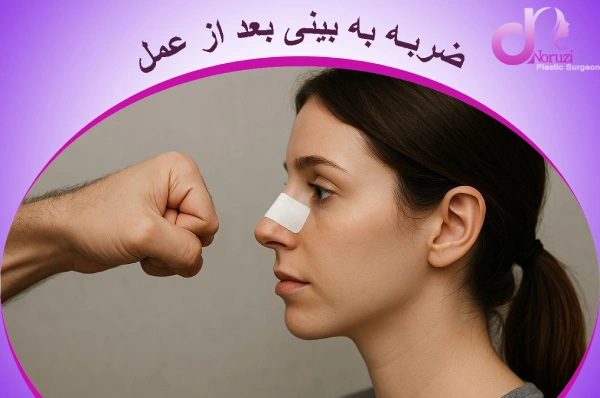 چرا ضربه به بینی بعد از عمل خطرناک است؟